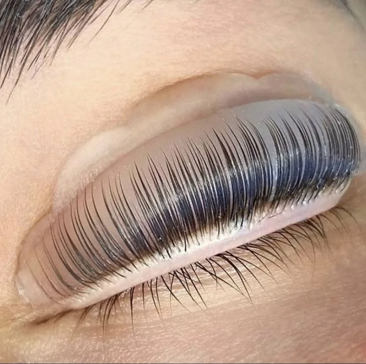 PROVISORIO — trocar por foto de cilio reto